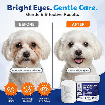 AKC Pet Eye Wipes for Dogs & Cats – Tear Stain Remover & Eye Discharge Cleaner – Hypoallergenic Grooming Wipes, 100 Count (Unscented) AKC 3 * 3" PET Eye Wipes UNSCENTED 100 Count